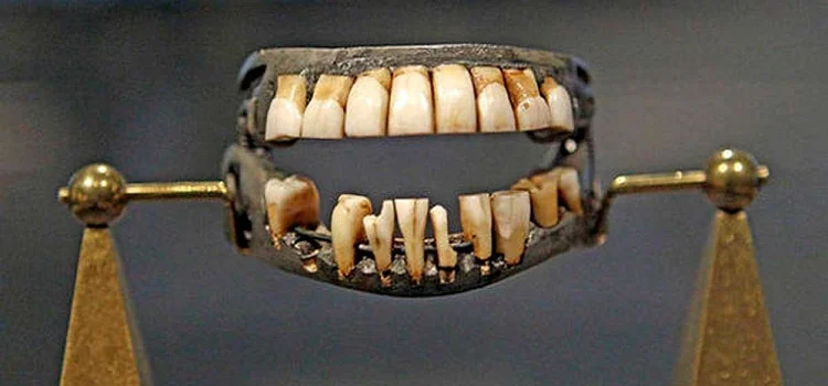 dantu protezu istorija